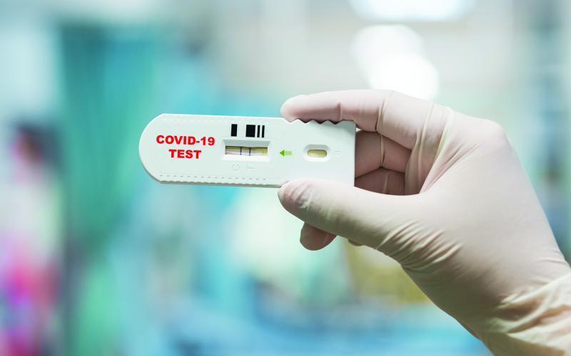 A generic photo of a sample COVID-19 test.